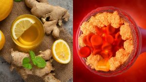 Ginger -Reducing Cholesterol- Levels